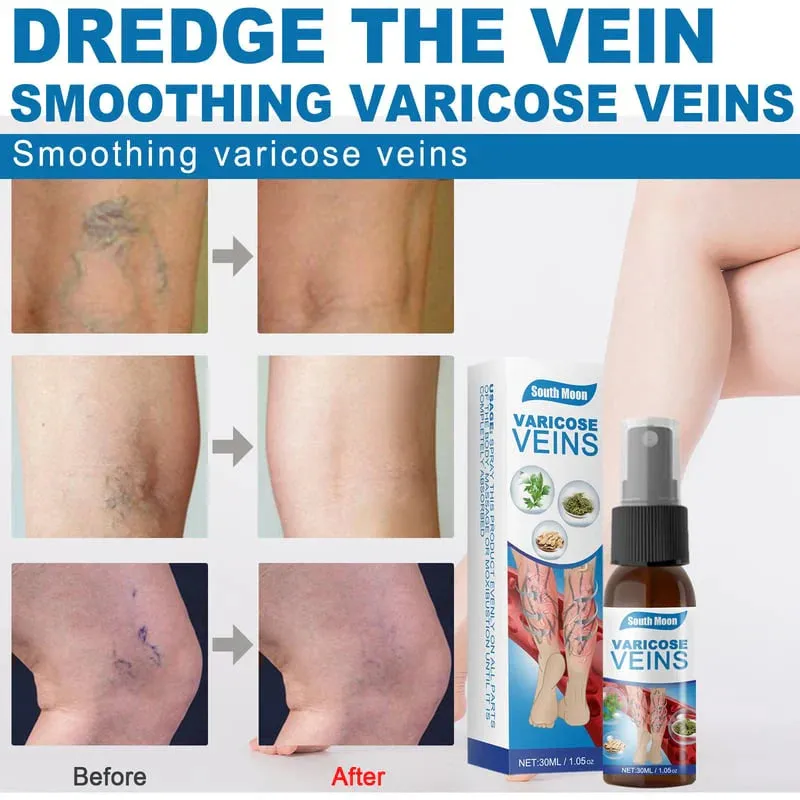 Furzero Bee Venom Varicose Veins Spray  BUY 1 GET 2 FREE 
